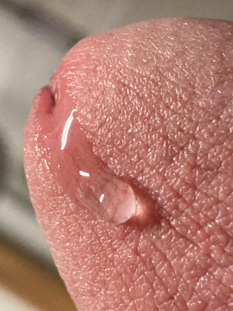 [22] Are closeups appreciated? posted by Icy-Sea-3641