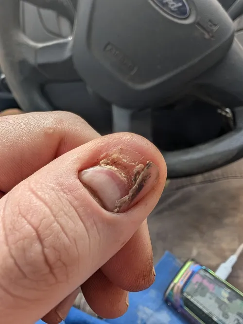 25day update on thumb by GreenEngrams