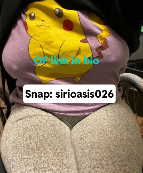 26f bilateral leg amputee new content! by sirioasis26