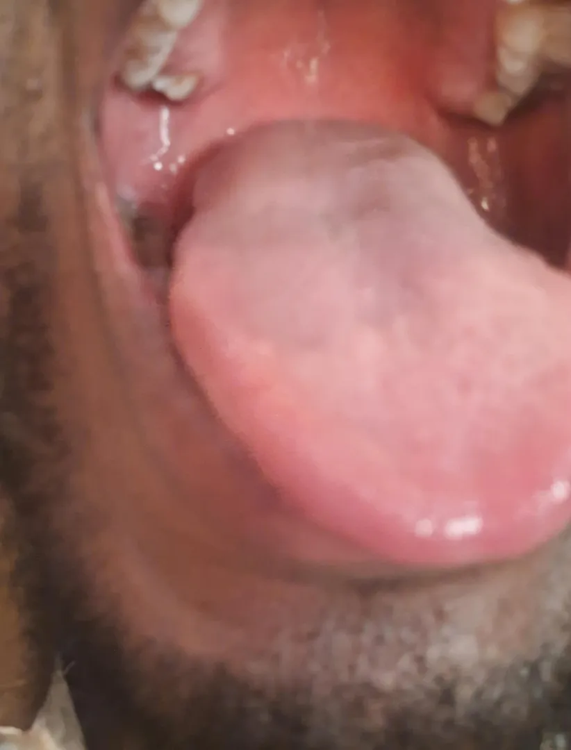 29M #zimbabwe - need a female to drop a huge warm load of poop down my throat posted by Actual-Signal3312