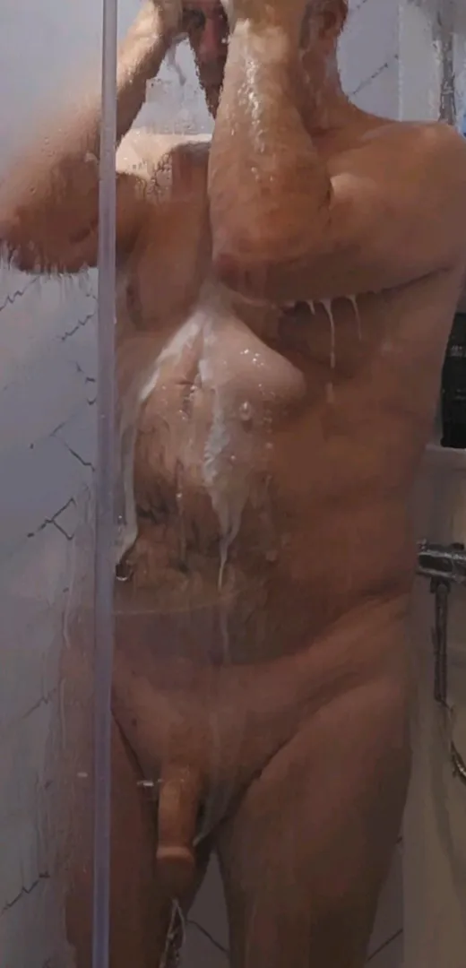 3 years old scar now [58] posted by Ambitious_Angle_2710