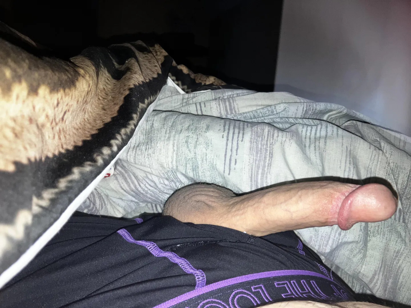 (34) cut at birth and again at 17 posted by crazykid9435