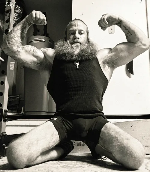 (34m spina bifida) by Fine-Reveal62