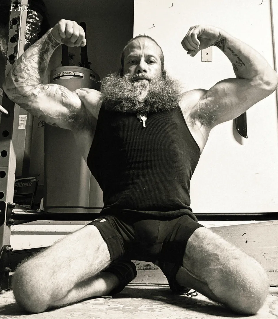 (34m spina bifida) posted by Fine-Reveal62