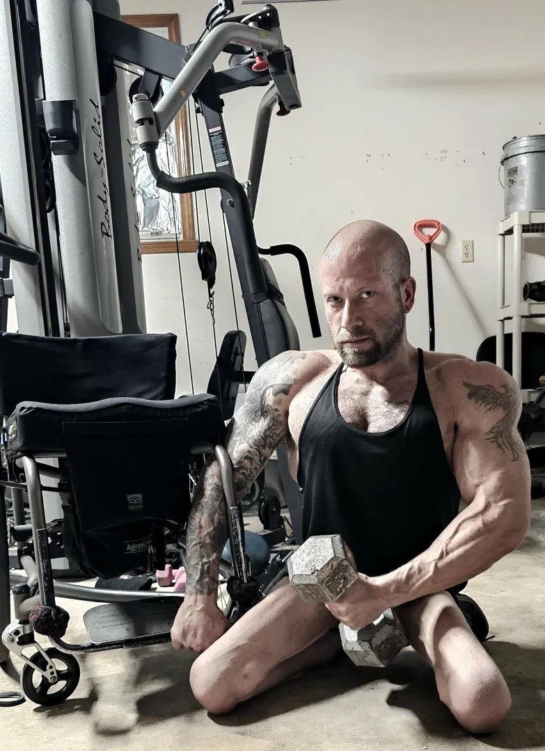 (34M. Spina bifida, para.) posted by Fine-Reveal62