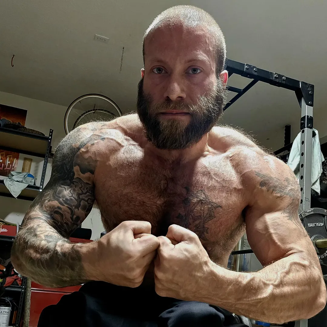 (34M Spina Bifida Para.) posted by Fine-Reveal62