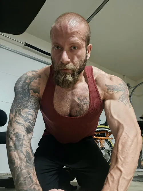 (34m. Spina Bifida, para.) by Fine-Reveal62