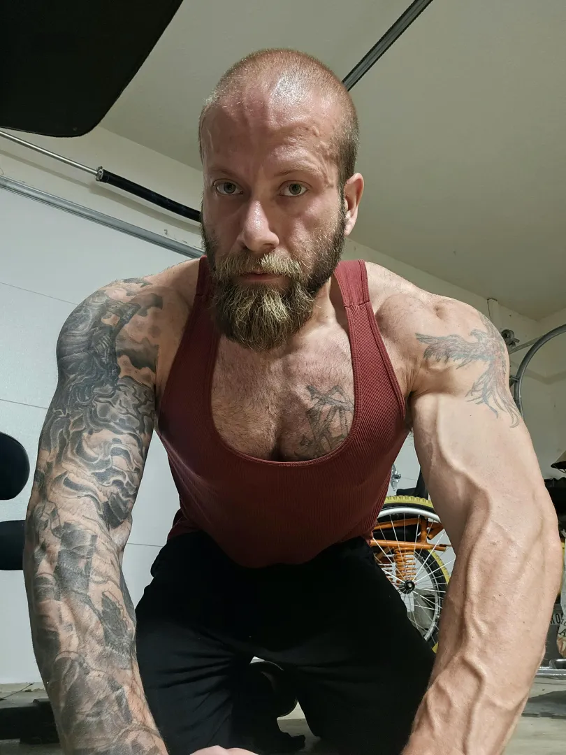 (34m. Spina Bifida, para.) posted by Fine-Reveal62