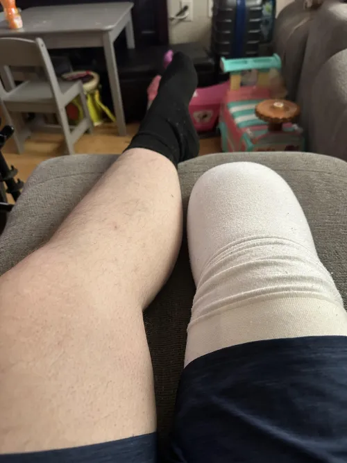 35 leg amputee looking for divotee! by Carsales-cowboy