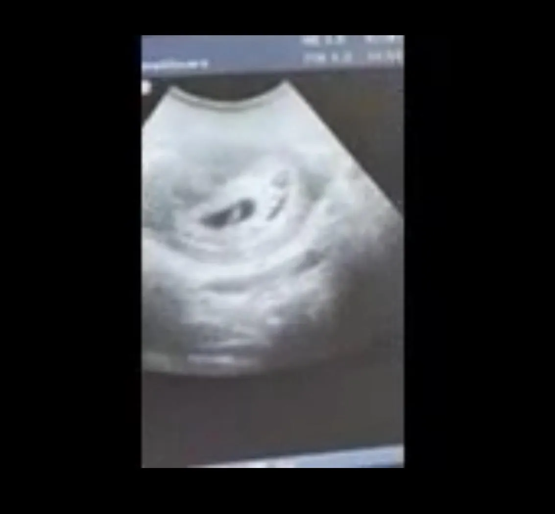 36 [M4F] #Miami 3 times successful breeder posted by Cutler_bay_NSA