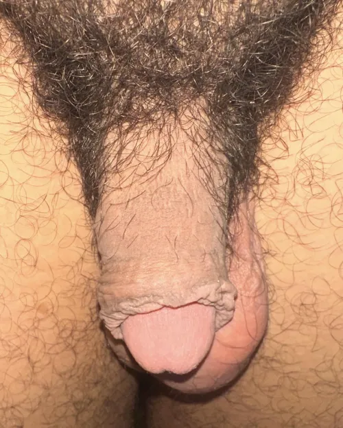 38 months by Mundane_Ad_5937