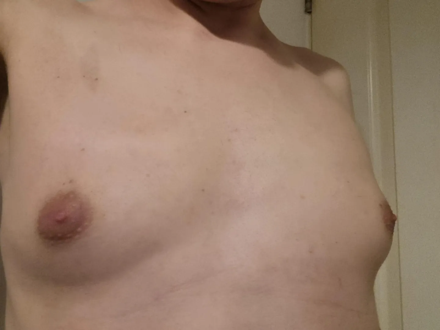 4 Months posted by Accomplished-Bit2630