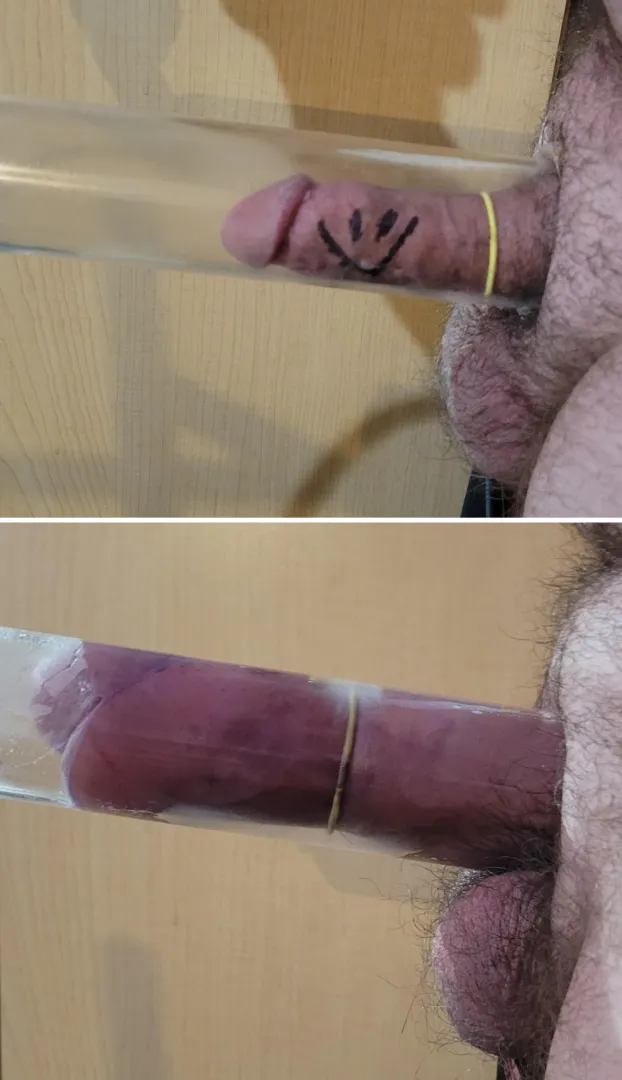 45 minutes into the pump posted by Biggerthebetter42