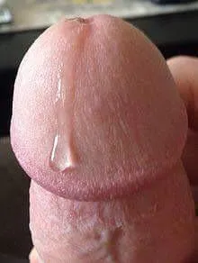 61 M drippper posted by Fluid-Branch1380