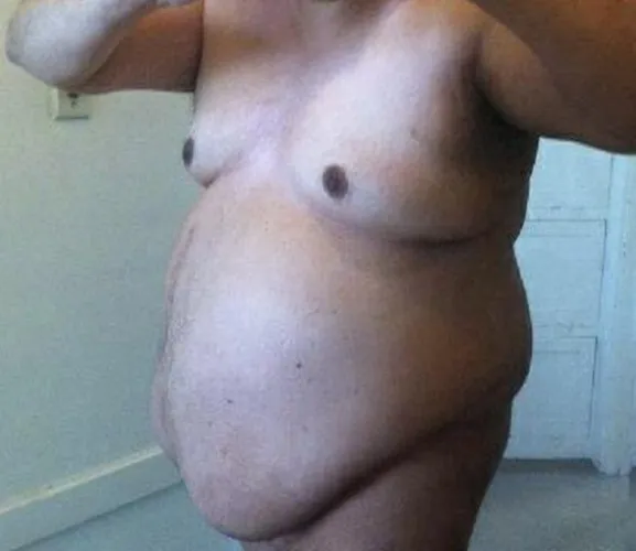 62 [M4F] #San Francisco - Are you a WOMAN seeking humiliation & degradation? If so, then this Fat, Ugly, Old Pervert is just what the doctor ordered! NOTE: I’M LOOKING FOR WOMEN IN THE SAN FRANCISCO BAY AREA ONLY FOR REAL-TIME PLAY. I’M NOT INTER by FatUglyOldPerv