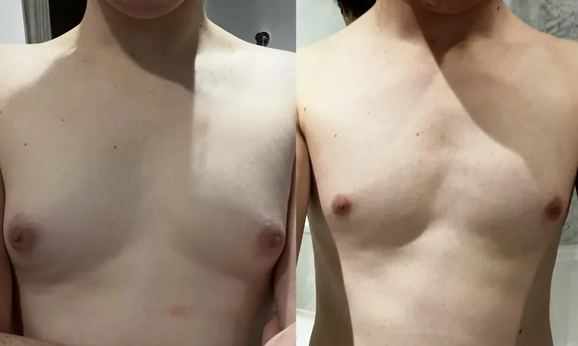 7 months vs 1 month HRT by mangopunchers