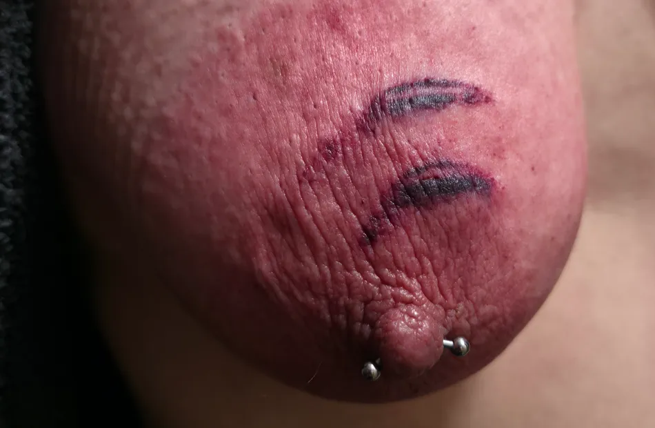 A Beautiful Close-Up of the Aftermath posted by LatexLibra