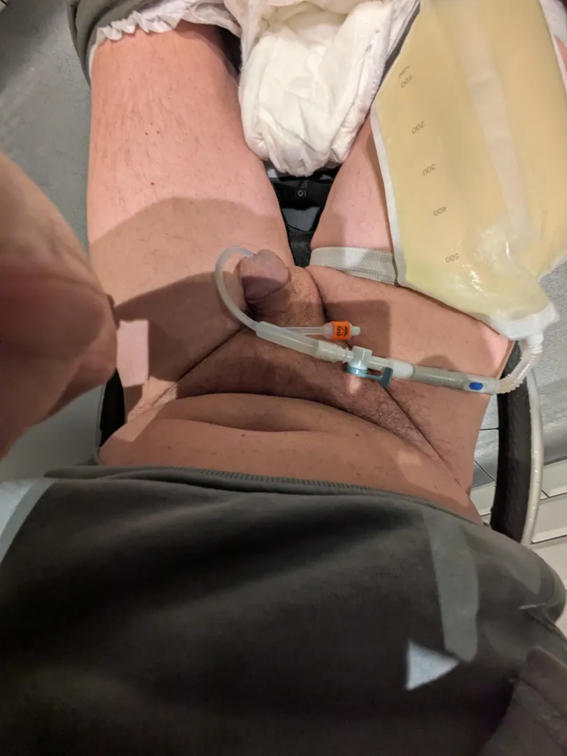 A full pee bag posted by Friendly-Monk-4837