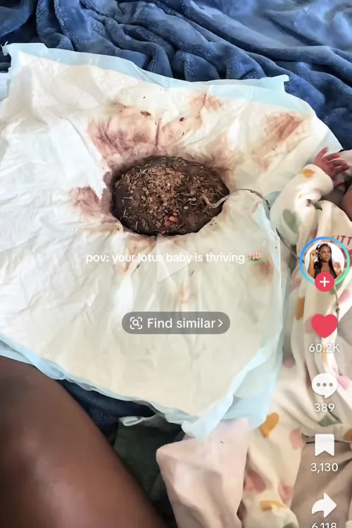 A mom on TikTok decided to not have her babies umbilical cord cut by moodycheerleader