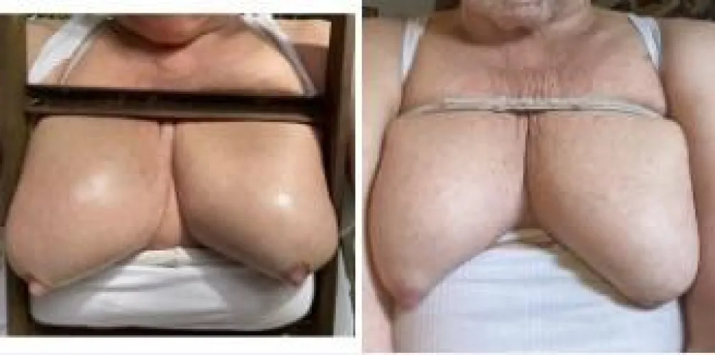 A year ago& today by Comprehensive_Sir999