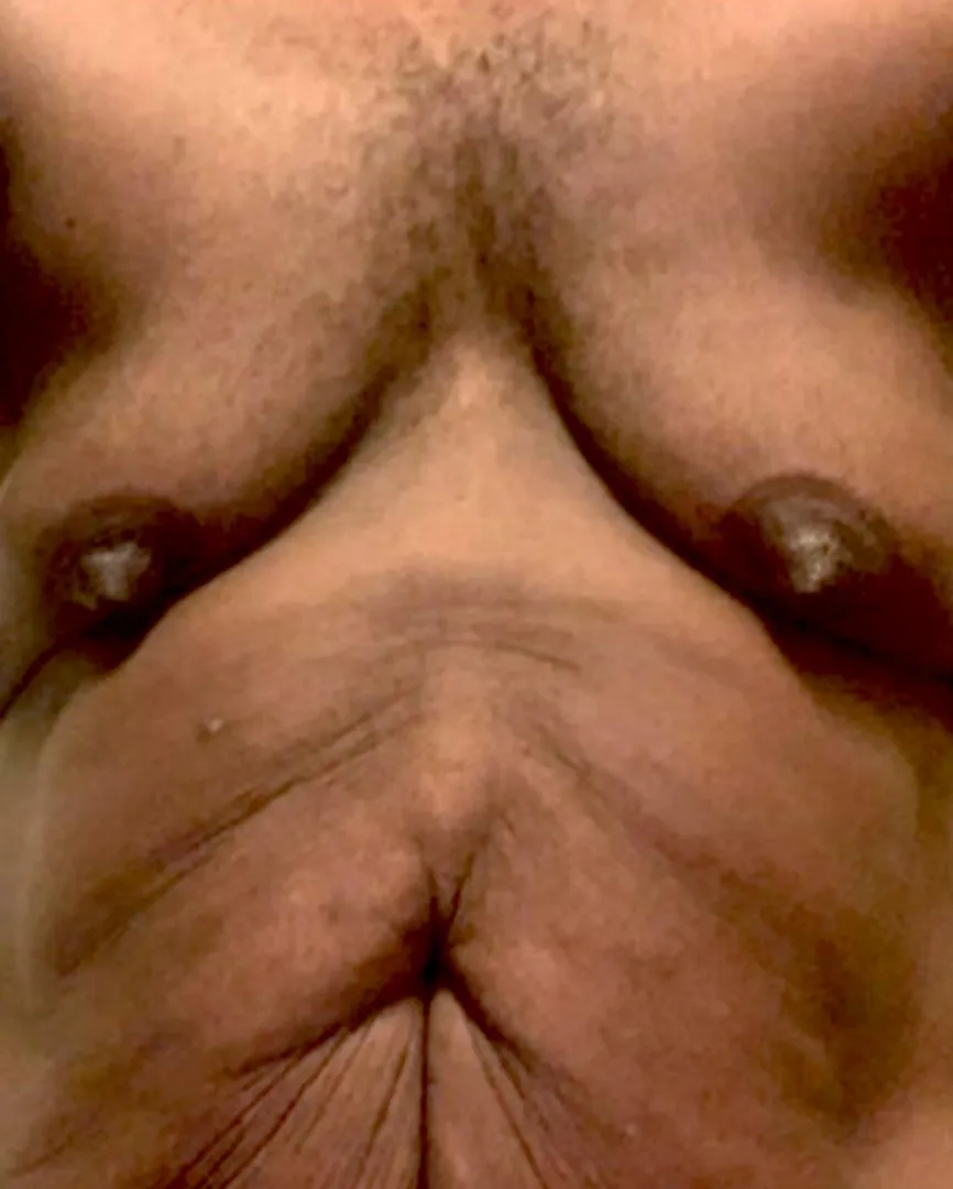 After a good pump posted by Own-Animator2674