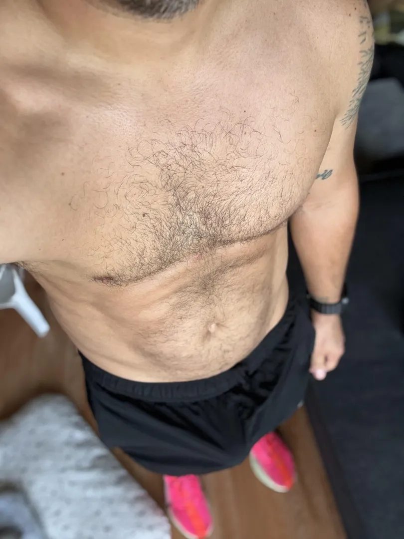 After run endorphins posted by TronBomb038