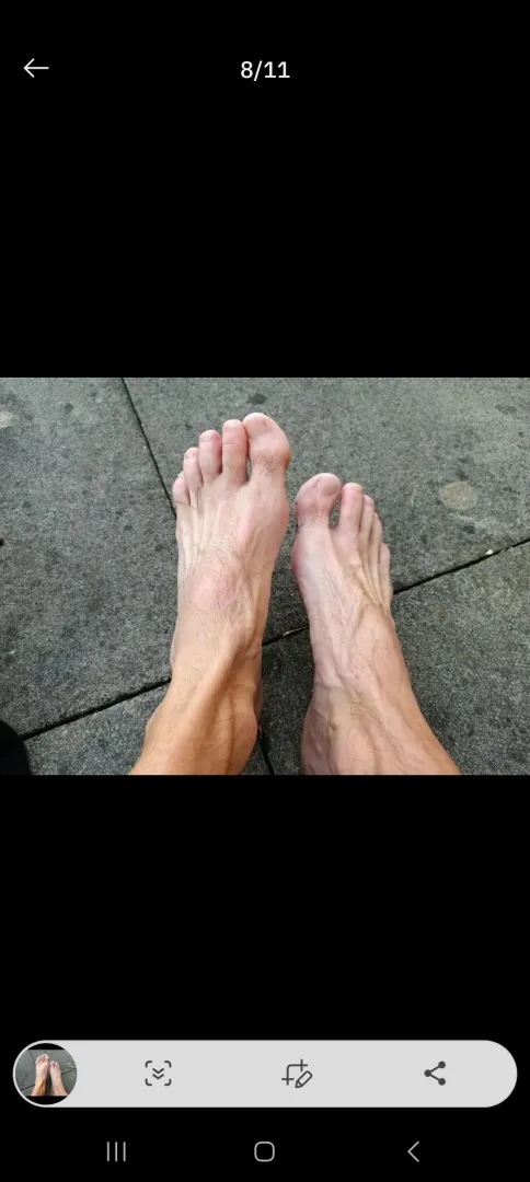 After work feet posted by Smooth_Penalty_2742