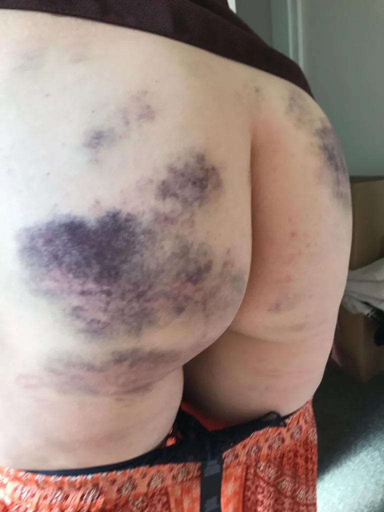 Aftermath, she's lost without her marks. posted by TitusPullo-