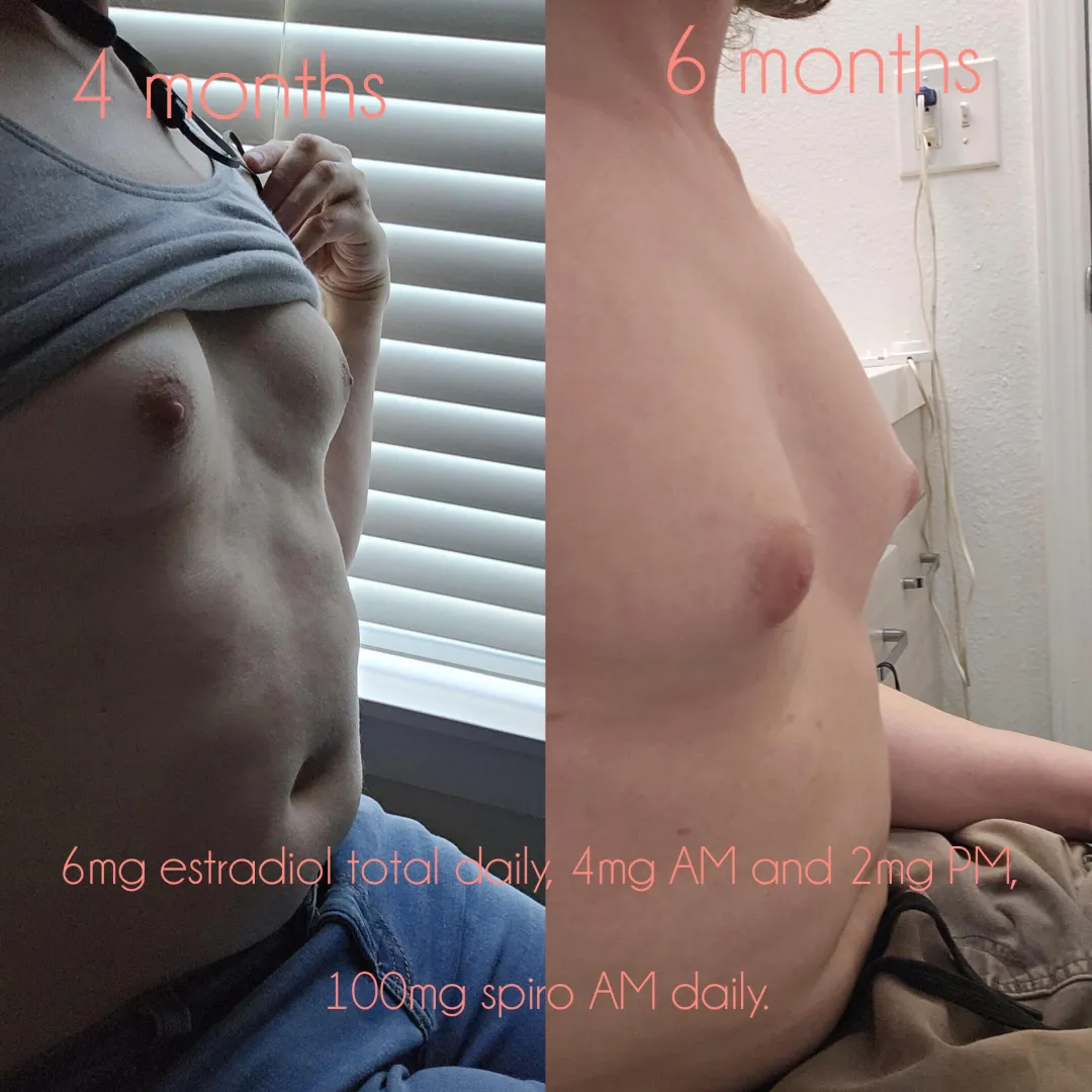[Age 32] 4 months vs 6 months posted by TheDoomedEgg
