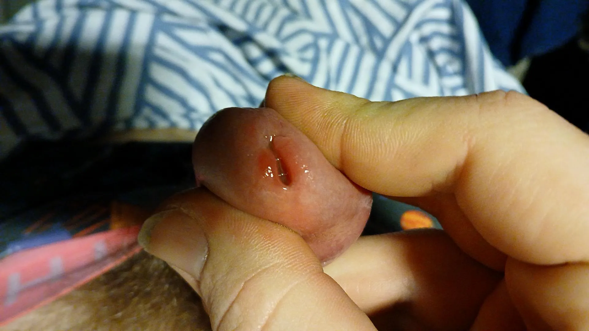 Al little sore one now .... I think al foley its a big no no for now i think also I go up a size if it have heald ... posted by baak20001