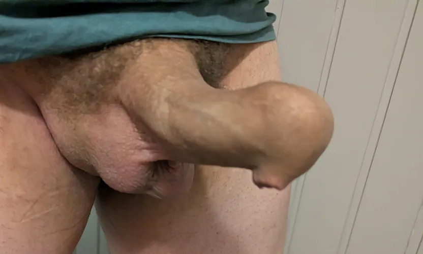 Almost poking through the screen by Alternative-Force975