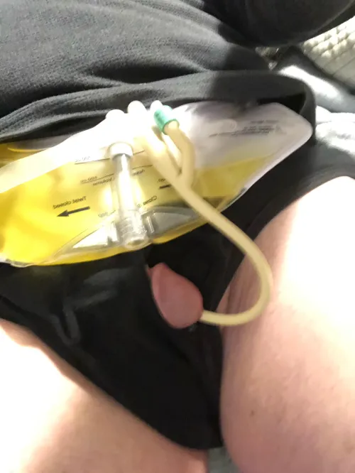Almost ready for bed with my Bardex I.C. 14 Fr Foley Catheter by CathRyder