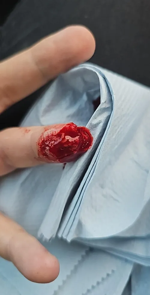 Another angle of the finger tip I posted earlier by Spark_Chaser