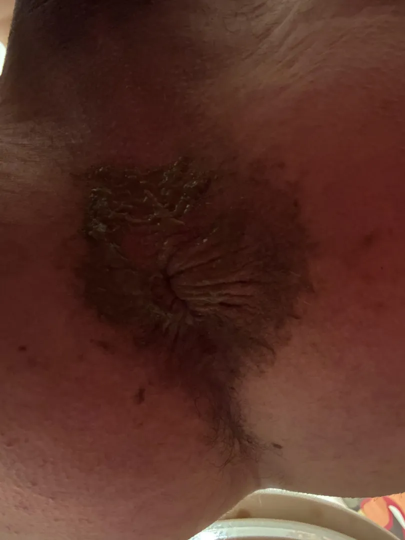 Anyone Have a Tongue I Can Barrow? posted by WorthMenu4515