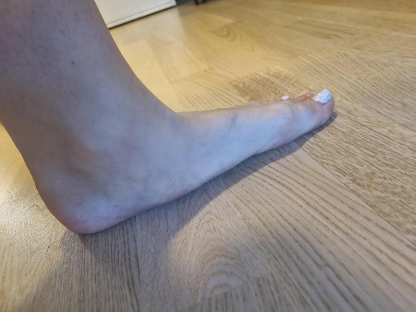 Anyone interested in flat feet? posted by Round-Conversation59