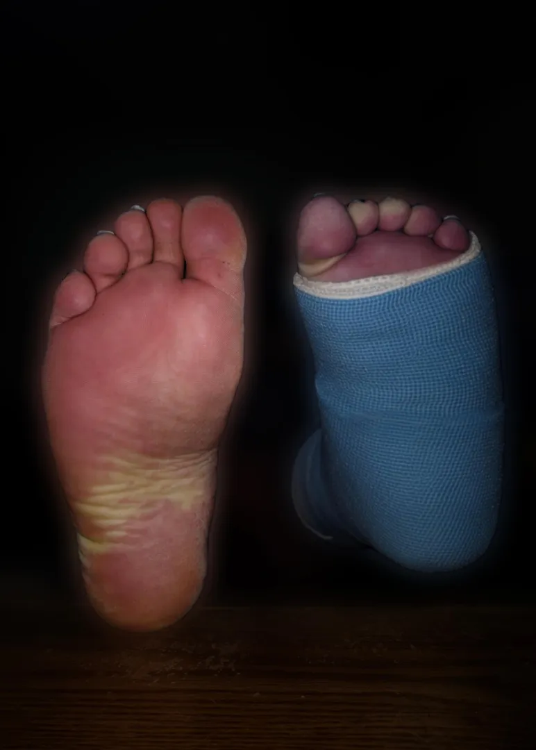 Anyone wants to use my feet? They are free ♥️ posted by Elegant-Morning-8580