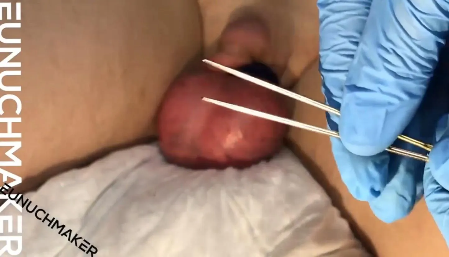 Are massive needles significantly more painful to stir with than tiny needles? posted by MichaelangeloOfBondo