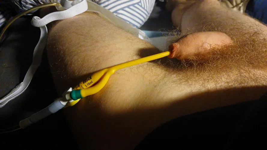 Are there any Dutch people with a catheter in this group? by baak20001