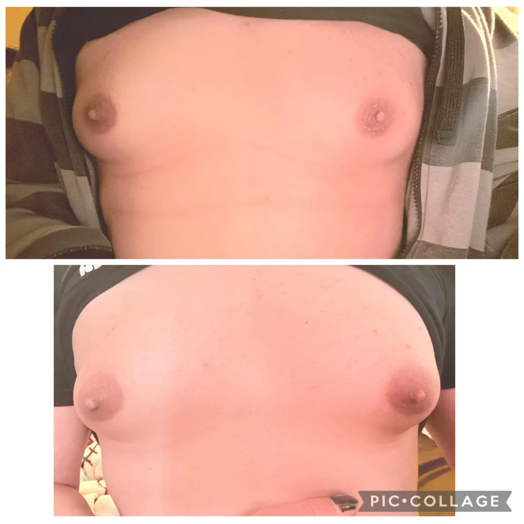 Areola changes in 13 days. Top image taken February 6, bottom image February 20. 4 months total hrt on February 23rd. Started October 23rd 2025 at 34 years old. posted by GamingIsLife91