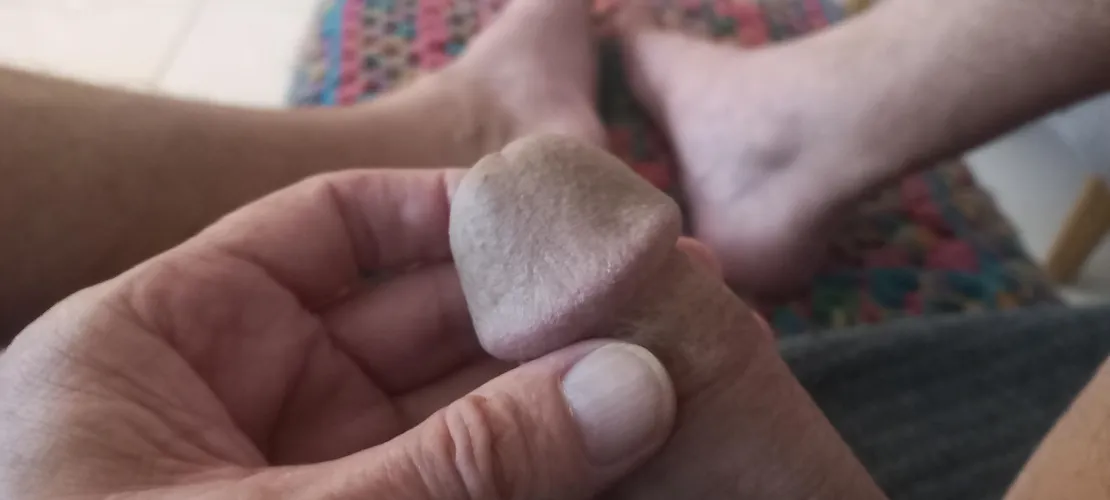 Aussie knob by xtangent