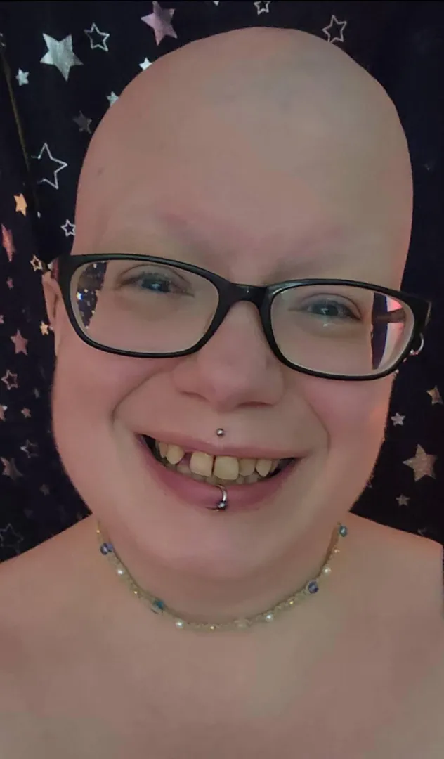 bald and lost in the stars tonight  posted by BoneWitchNun