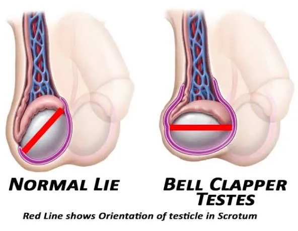 Balls changing position posted by LostNLosingSanity