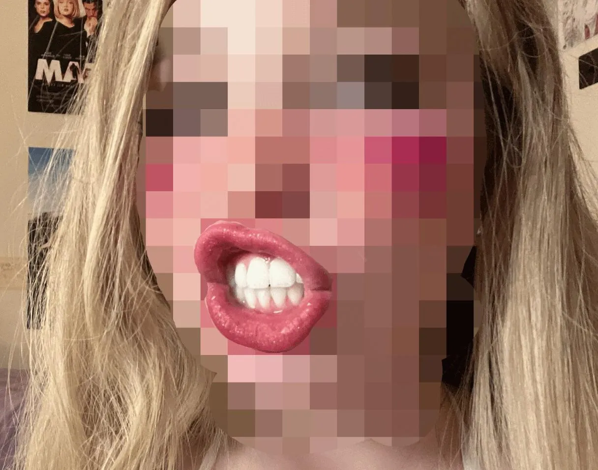 Be weak for her teeth posted by FatPigMarissa