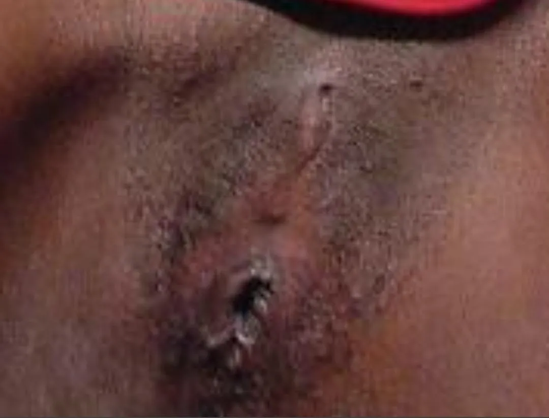 Beautiful lipless skin and hole posted by chicosimpatico