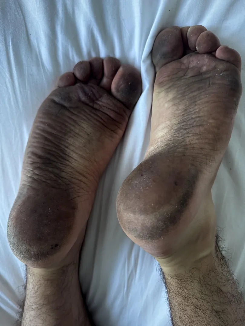 been a while since i went barefoot  posted by Mission-Half-4689