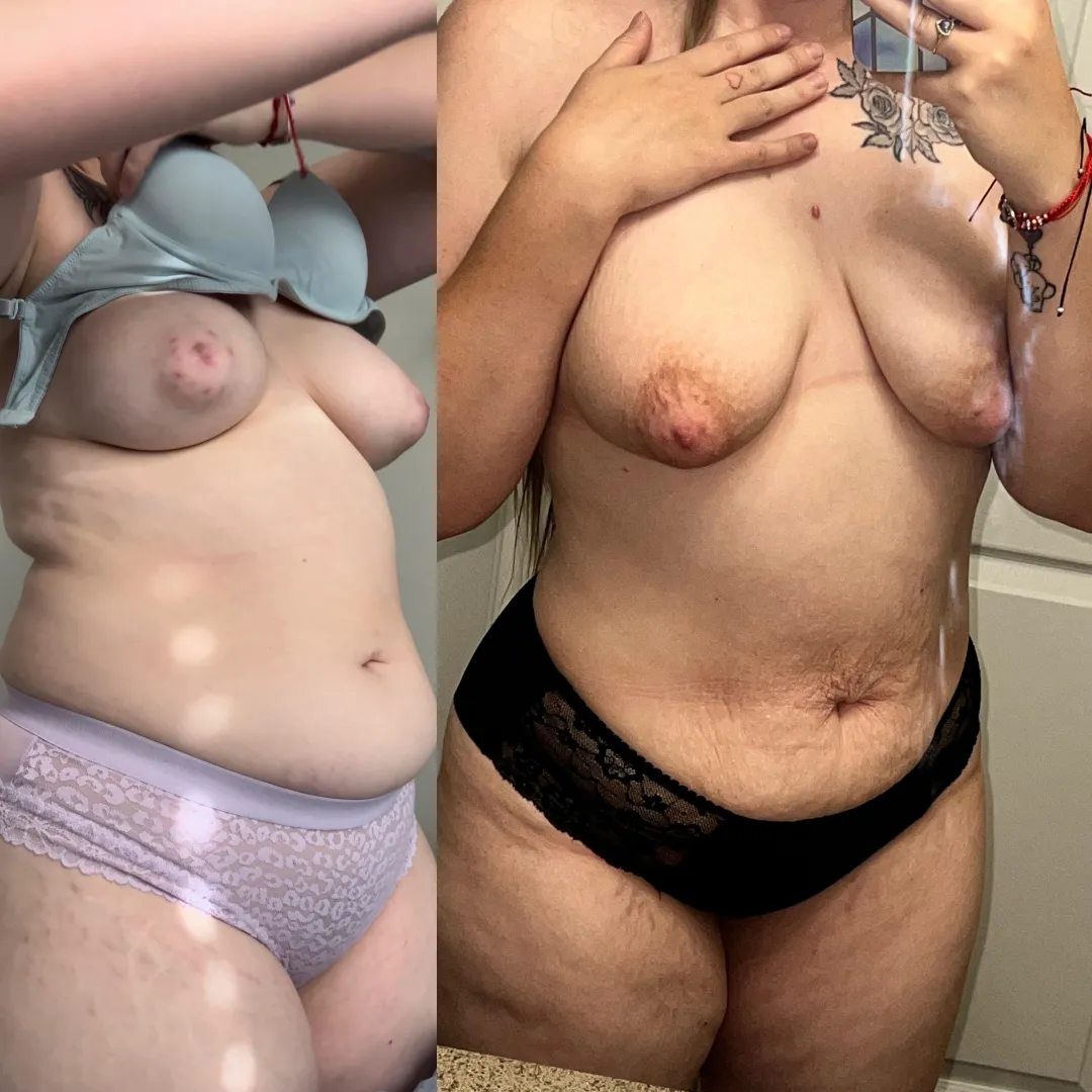 Before and after my pregnancy posted by glazzedjazz
