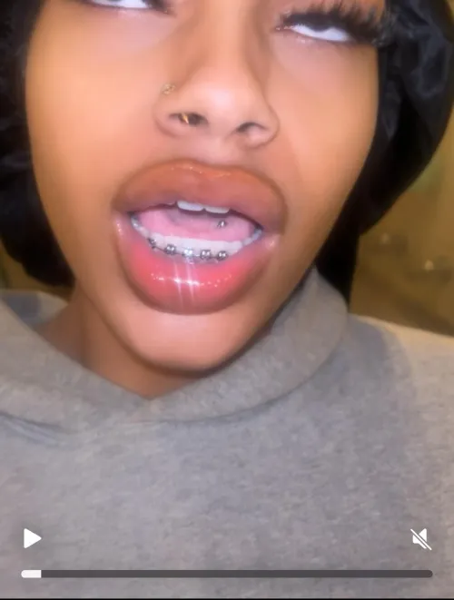 Best combo, braces and a tongue piercing by mspinklipss