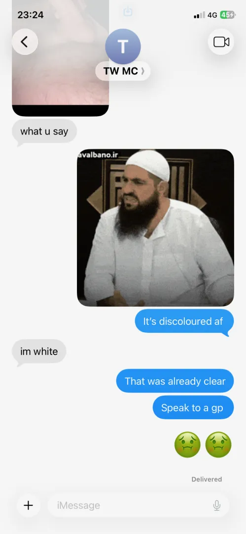 Best way to bat off d pics posted by thisisnotascamm