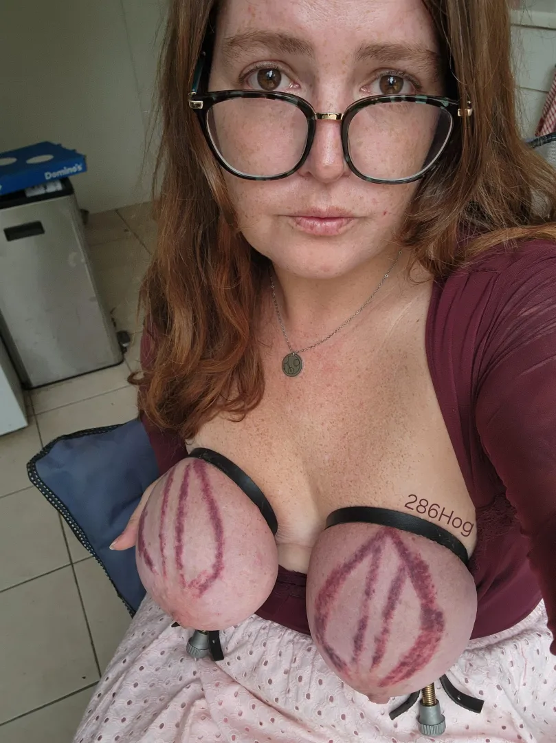 Big boobs, freshly bruised  posted by 286Hog