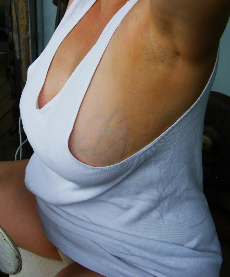 Big side on display. posted by smoothlines